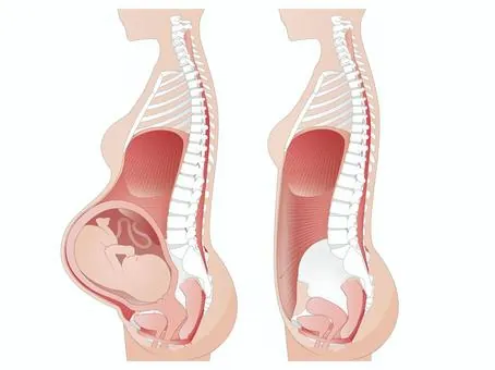 Illustration showing how the abdominal core and pelvic floor change during pregnancy